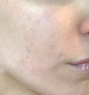 After 3 weeks
