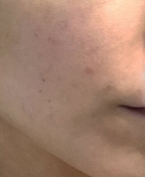 Before